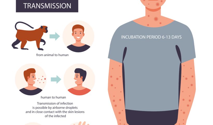 ＷＨＯ　サル痘「緊急事態」終了も「今後も警戒要する」（5/22）