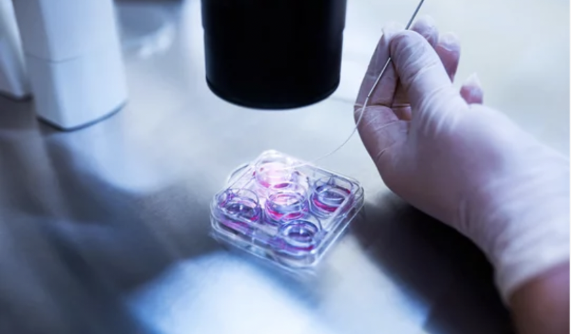 遺体から採取した精子で体外受精へ　フロリダ州（3/16）