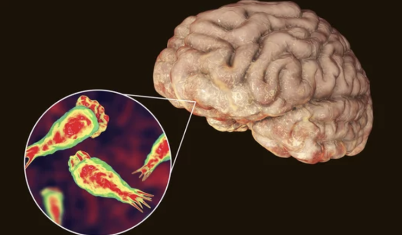 ネバダ州の2歳男児、温泉入浴後に脳をむしばむアメーバで死亡（7/24）