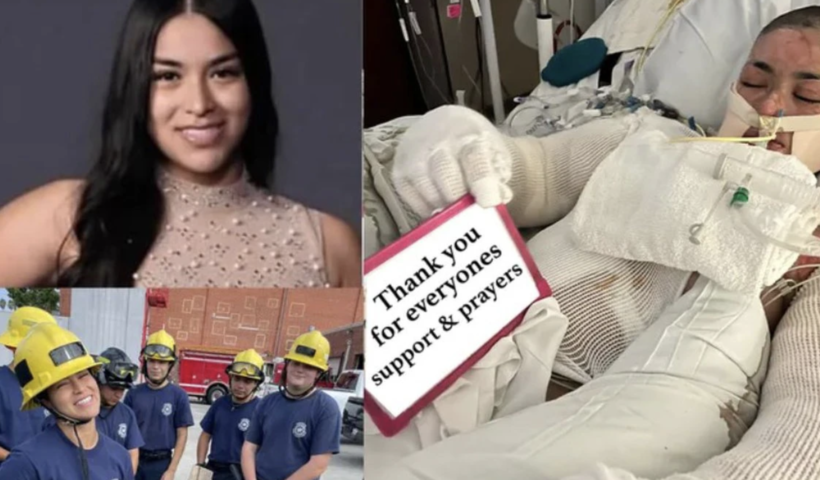 消防士目指す17歳少女、火災事故で重度のやけど　病床から「神からの試練」（9/19）