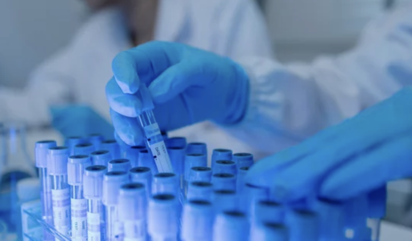 リバーサイド郡の高校で結核症例を確認　保健当局（9/5）